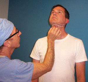 drsullivan-kybella-patient