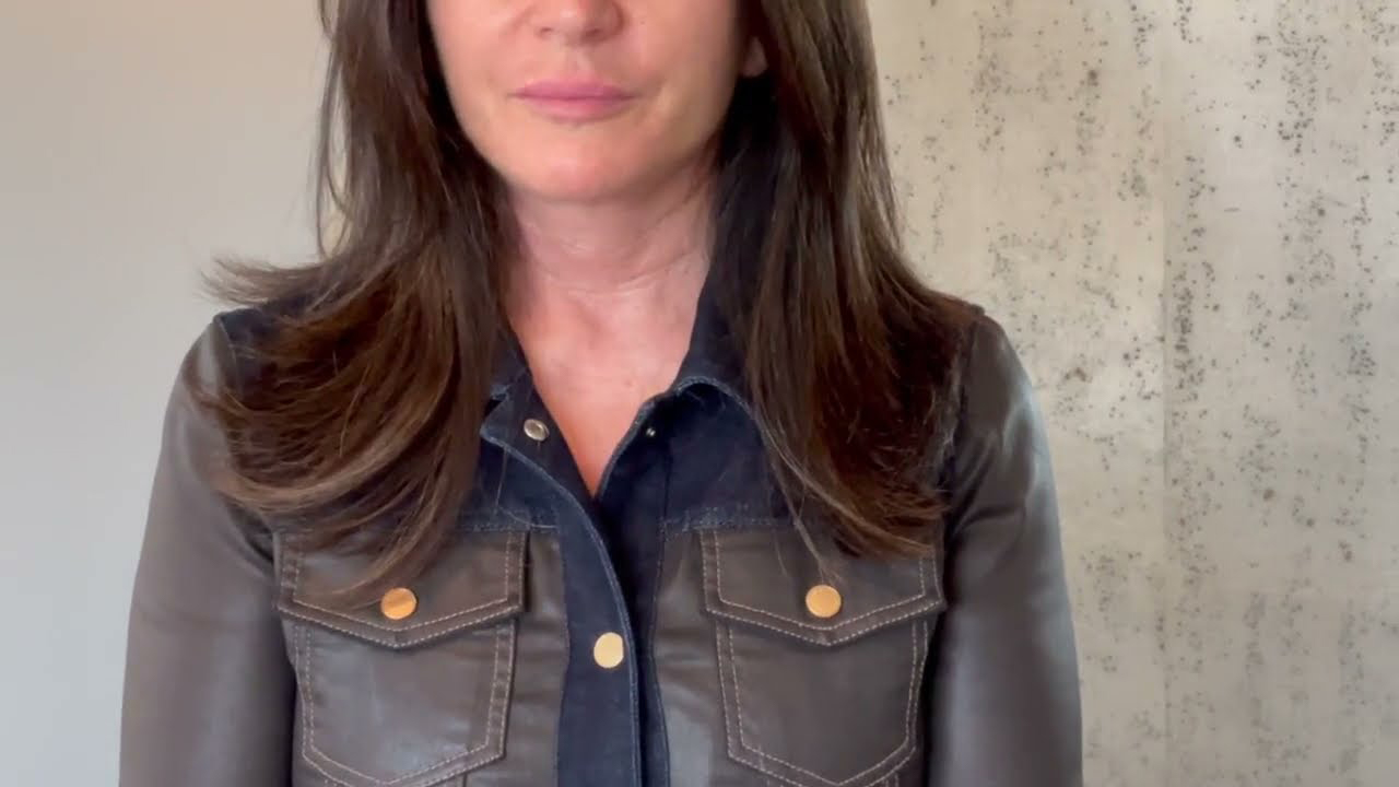 3 Week Neck Lift Results
| Patient Perspective