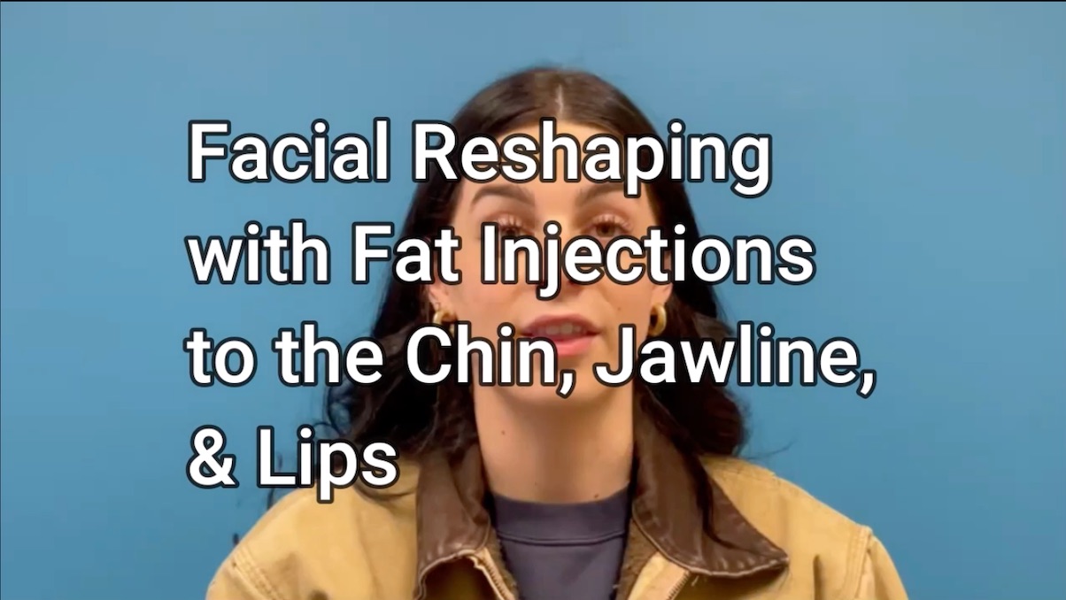 Facial Contouring Part 3 | Patient Perspective