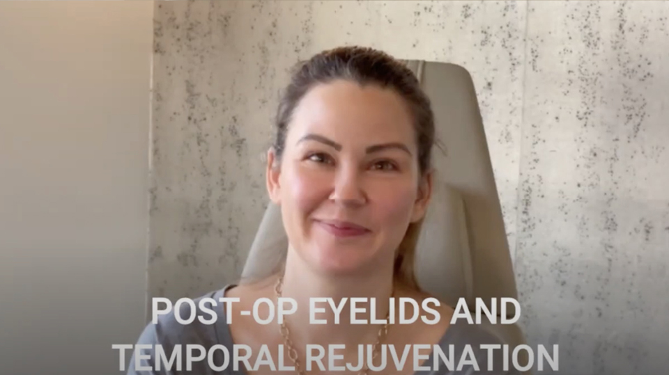 Post-Op Eyelids and Temporal Rejuvenation